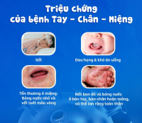 TUYÊN TRUYỀN THÁNG 10- Phòng chống bệnh tay chân miệng 