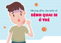 BỆNH QUAI BỊ